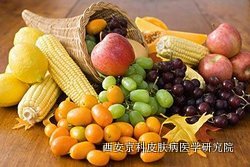 牛皮癣患者在饮食要注意什么