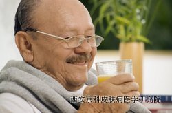 老年牛皮癣怎么治 老年牛皮癣怎么治