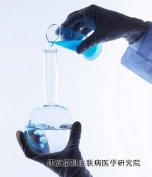 牛皮癣的危害 牛皮癣的危害