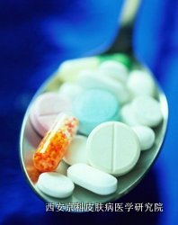 治疗牛皮癣究竟用什么药 治疗牛皮癣究竟用什么药