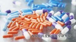 头部牛皮癣要怎么治疗