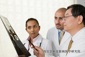 中医治疗牛皮癣的优点 中医治疗牛皮癣的优点
