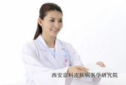 牛皮癣怎么治