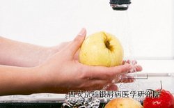 牛皮癣患者在生活中要注意些什么 牛皮癣患者在生活中要注意些什么
