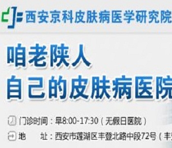 河南专科治疗牛皮癣医院 河南专科治疗牛皮癣医院