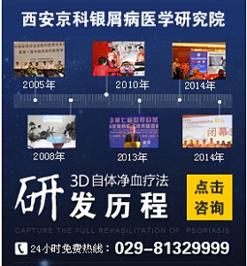 郑州哪个银屑病医院效果好 郑州哪个银屑病医院效果好