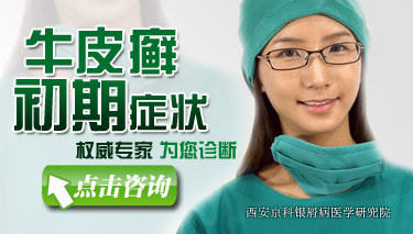 牛皮癣的早期症状图 牛皮癣的早期症状图