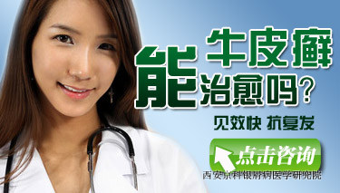 牛皮癣早期发病原因 牛皮癣早期发病原因