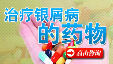 吃什么药治疗牛皮癣 吃什么药治疗牛皮癣