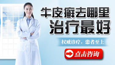 牛皮癣治疗要注意什么 牛皮癣治疗要注意什么
