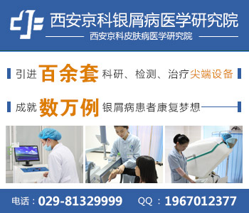 郑州牛皮癣治疗医院 郑州牛皮癣治疗医院