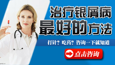 怎么治疗面部牛皮癣 怎么治疗面部牛皮癣