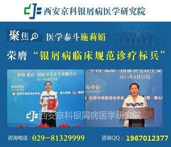 郑州哪家银屑病专科医院好 郑州哪家银屑病专科医院好
