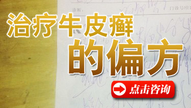 牛皮癣治疗偏方 牛皮癣治疗偏方