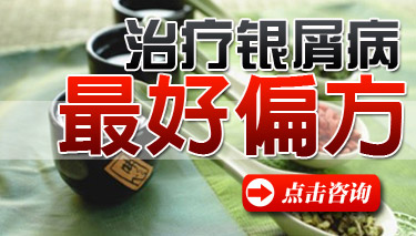 偏方治疗牛皮癣 偏方治疗牛皮癣