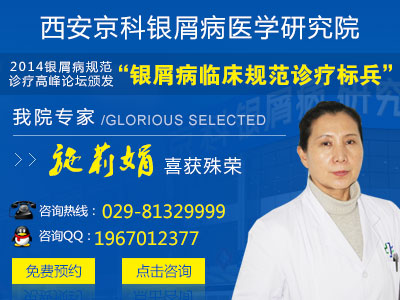 河南省哪里治疗牛皮癣好 河南省哪里治疗牛皮癣好