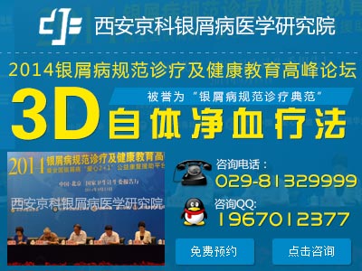 郑州哪个医院治银屑病权威 郑州哪个医院治银屑病权威