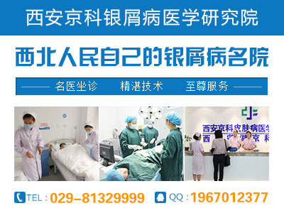 渭南市哪里治疗牛皮癣好 渭南市哪里治疗牛皮癣好