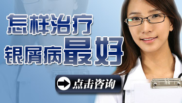 怎样治好银屑病 怎样治好银屑病