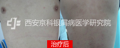 后.jpg